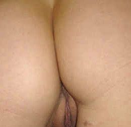 Rosettenfick